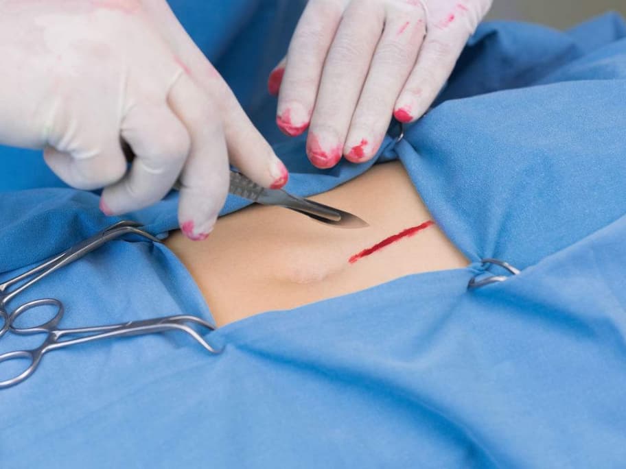 Implantasi Partikel